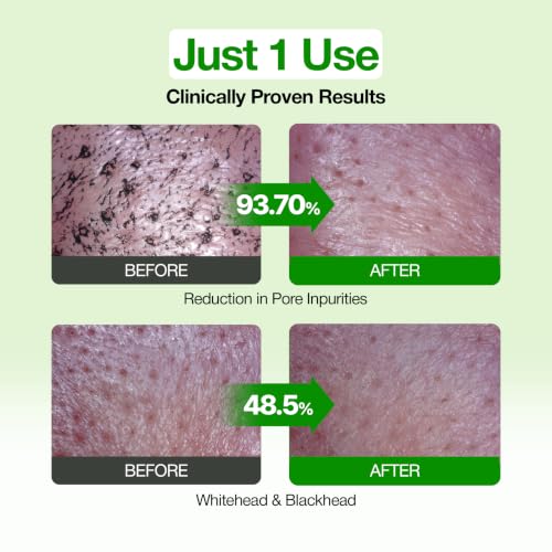 Green Tomato Pore Cleanser & Mask for Deep Cleaning, 4.05 Fl Oz Pack of 2