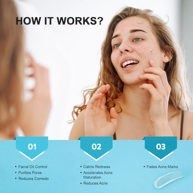 Acne Pimple Spot Treatment Cream: Cystic Hormonal Breakouts Control for Face & Back - 2% Salicylic Acid, Fast Redness Relief, Fades Blemishes & Post-Acne Marks, Teens-Adults, 1.8 oz