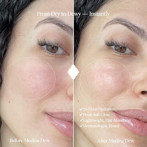 WHIND Medina Dew Facial Moisturizer ? Rose Water & Hyaluronic Acid Hydrating Cream ? Gentle, Lightweight Face Moisturizer for Radiant and Dewy Skin ? 50ml