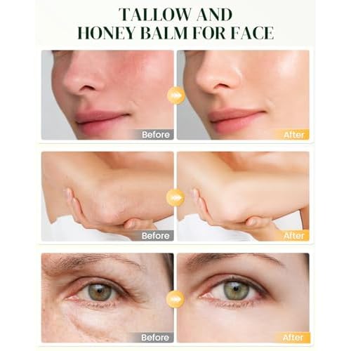 Beef Tallow for Skin: Whipped Beef Tallow Cream for Face & Body, Natural Moisturizing Cream with Honey and Beeswax, Grass-Fed Beef Tallow &Honey Blend, Lightweight Hydration for Dry Skin, 4.2Oz