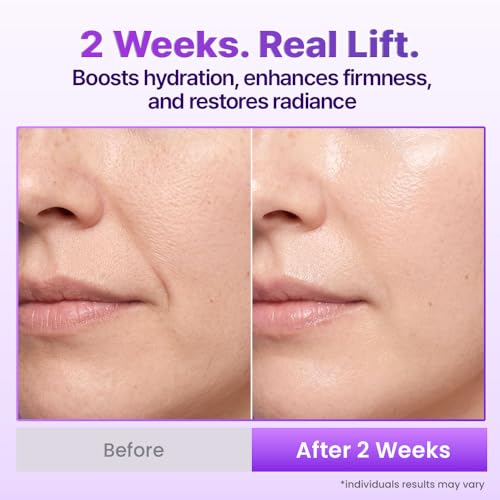 BIOHEAL BOH Probioderm 3D Lifting Face Mist - Hydrating Anti-Aging Spray for Glow & Firmness