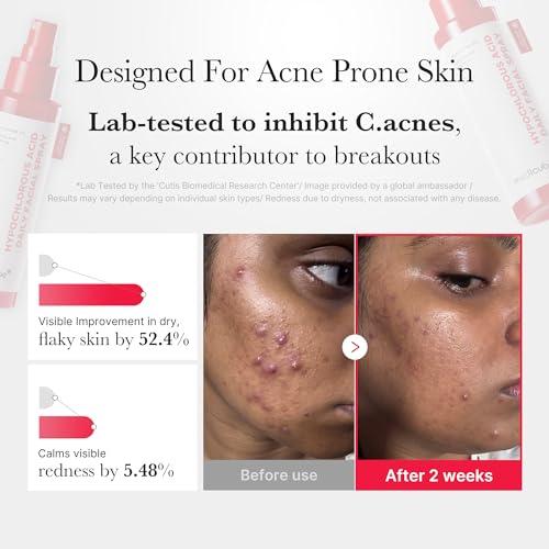 medicube Swipe & Spray Red duo for Troubled Skin: Red Succinic Acid Panthenol Facial Peeling Pads and Power Soothing Spray