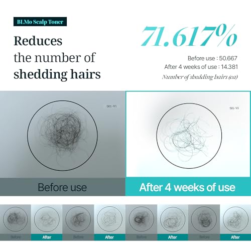 Hair Growth Serum for Thinning Hair and Scalp Health - Clinically Proven & Drug-Free, 4.05 fl oz