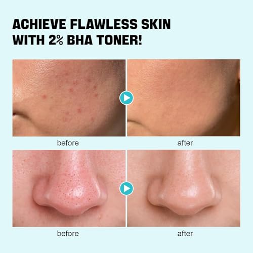 BHA Toner with Niacinamide for Face, Exfoliating Liquid for Blackheads & Pores - 6.76 Fl Oz Pack of 2 (Variation of THIS listing)