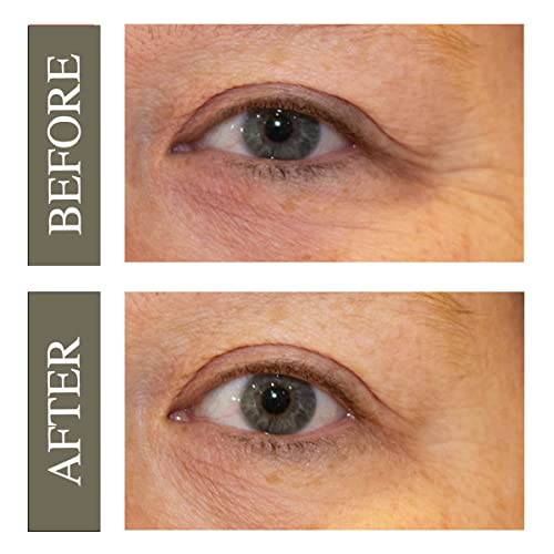 Hey Honey Brightening Eye Serum for Dark Circles & Puffiness - Hydrating Under Eye Treatment - 0.5 oz