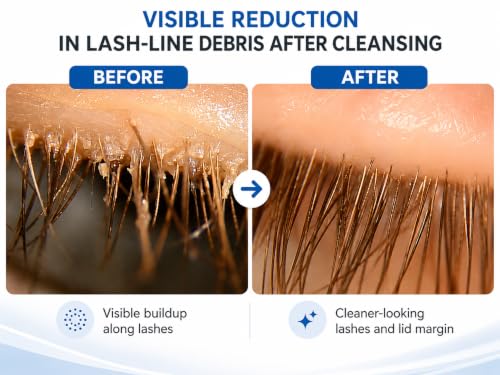 Hydrating Eyelid and Lash Cleansing Gel with Manuka Honey Aloe Vera Coconut Oil