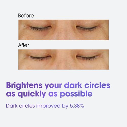 Retinol Eye Cream for Dark Circles and Fine Lines - Brightening & Anti-Aging Serum, 30ml