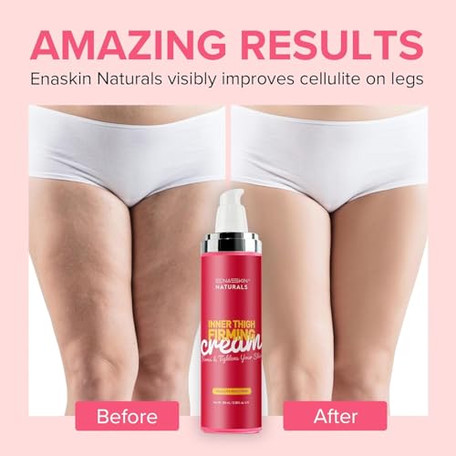 Enaskin Naturals Anti Cellulite Body Firming Cream: Cellulite Remover for Legs & Inner Thigh- Skin Tightening Lotion for Womens' Booty, Stomach & Belly with Acetyl Hexapeptide-8 & Caffeine, 100 ML