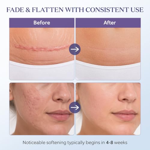 Medical Grade Silicone Scar Gel 1.7oz Pack of 2 - Fragrance-Free, Fast-Drying, Sensitive Skin