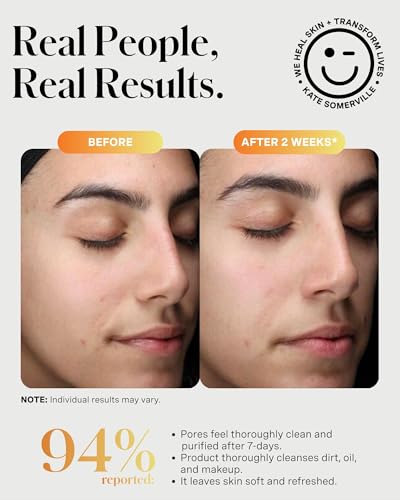 Kate Somerville ExfoliKate Cleanser 1.7 Fl Oz - Gentle Foaming Facial Wash for All Skin Types