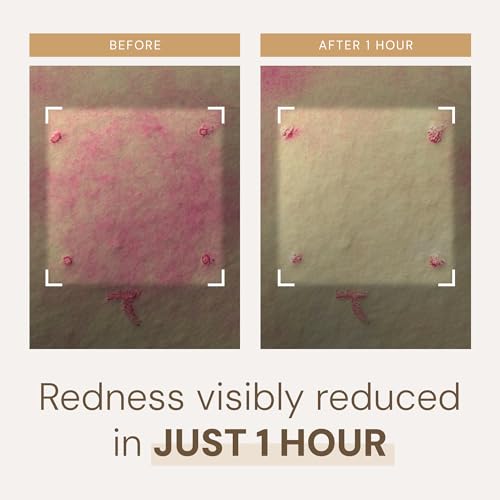 Moisturizing Skin Barrier Cream with Ceramides & Rice Extract – Hypoallergenic, Dermatologist Tested