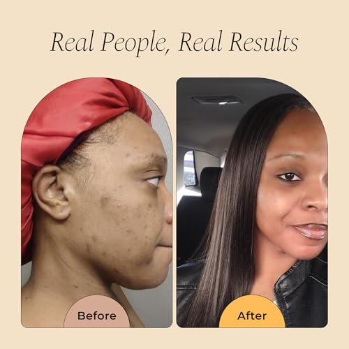 Natural Brightening & Soothing Facial & Body Oil - Deep Hydration