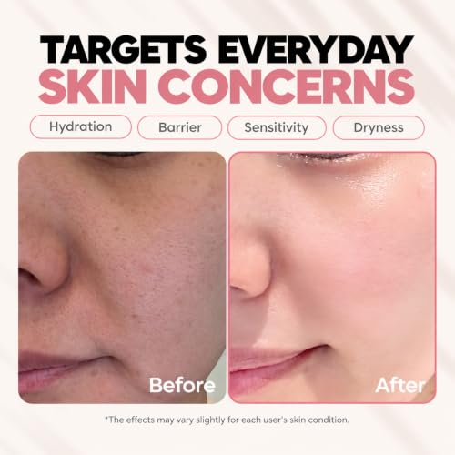 Ceramide Ectoin Hyaluronic Acid Moisturizer for Sensitive Skin - Korean Barrier Repair Lotion