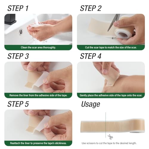 Silicone Scar Sheets,Silicone Scar Tape,Silicone Sheets For Scars,Scar Tape For Surgical Scars,Keloid Bump Removal,Scar Removal For Surgical(1.6"x 60" Roll-1.5M)