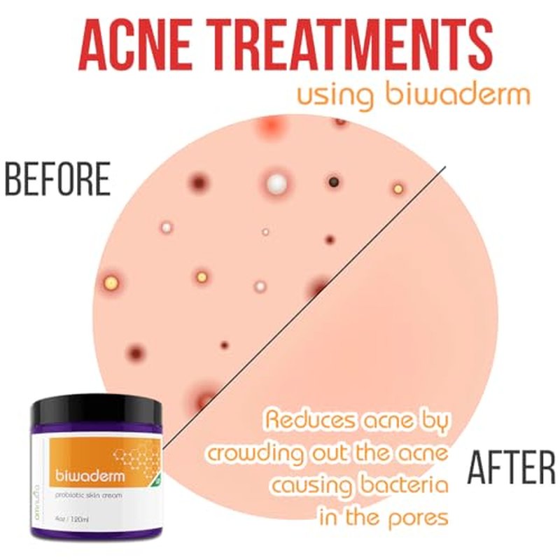 Biwaderm Probiotic Skin Cream - 4OZ Organic Based Topical Probiotics for Skin Care Eczema Treatment Psoriasis Treatment for Folliculitis Treatment Pure Aloe Vera Gel 4oz