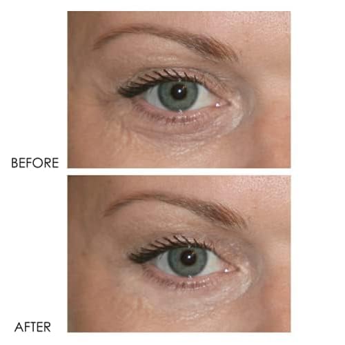 Dermelect Revitalite Eyelid & Dark Circle Corrector- Professional Strength, Anti-Aging Eye Cream with Peptides, Brightening & Tightening Ingredients- Dark Circles, Puffiness, Droopy Eyelids & Wrinkles