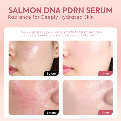 Salmon DNA Serum, 99% PDRN High-Purity Ampoule, Anti-Aging One Day Serum with Recombinant Collagen & Glutathione, Korean Skincare for Wrinkles, Deep Hydration, Firming, Glass Skin, 0.05 fl.oz x 30e