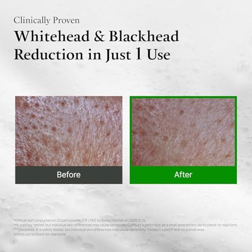 Green Tomato Pore Detox Mask & Toner Duo - Deep Cleansing & Pore Tightening