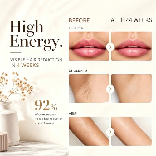 IPL Laser Hair Removal Device for Face Body Bikini Legs Painless Home Use