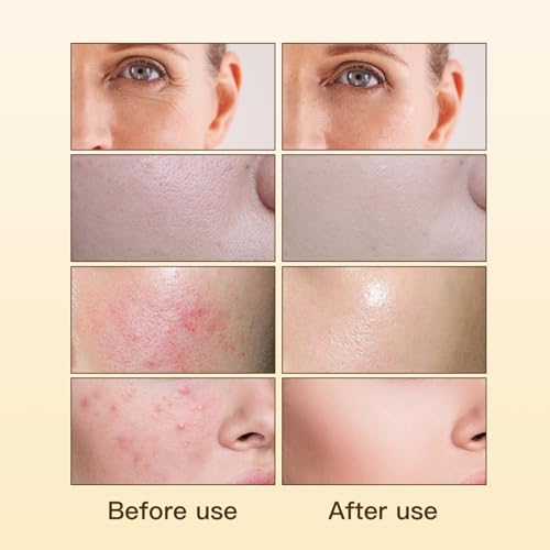 Face Serum with Madagascar Centella & Bakuchiol for Sensitive Skin - 45ml