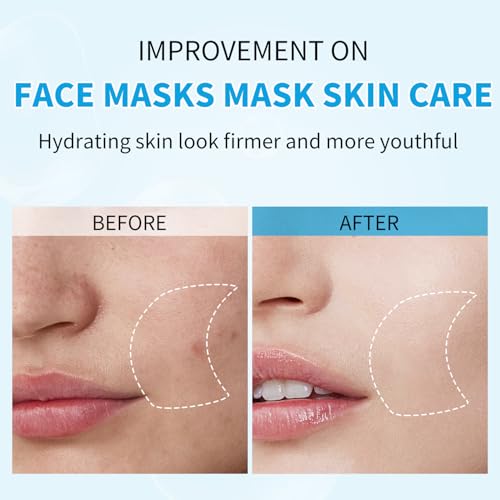 IREV Hyaluronic Acid Face Mask, Face Masks Skincare, Hydrating Mask For Face,Deep Moisturizing Face Sheet Mask, Facial Mask For All Skintypes, After Sun Face Mask, Hydrating Face Masks, Pack Of 10