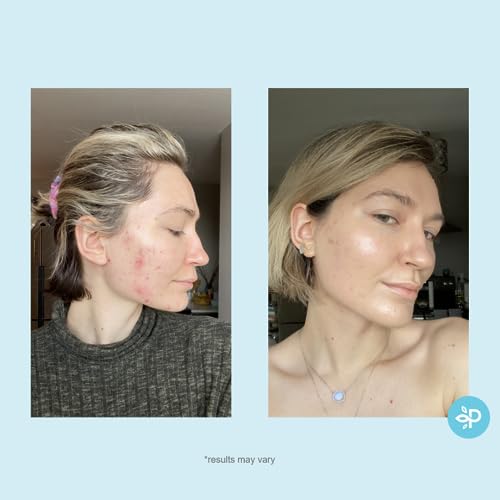 Perfect Image Hydro-Glo Peel Pads 10% Strength with Kojic & Natural Extracts