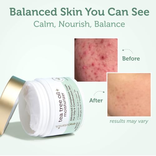 Era Organics Tea Tree Oil Face Cream - Salicylic Acid Acne & Blemish Moisturizer