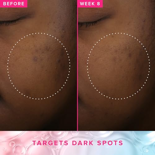 Farmacy 3% TXA Brightening Toner for Face - Dark Spot Corrector with Azelaic Acid, Tranexamic Acid + 5% PHA - Helps Even Texture + Tone, Fade Dark Spots + Exfoliate - Glow-Enhancing Skin Care (120ml)