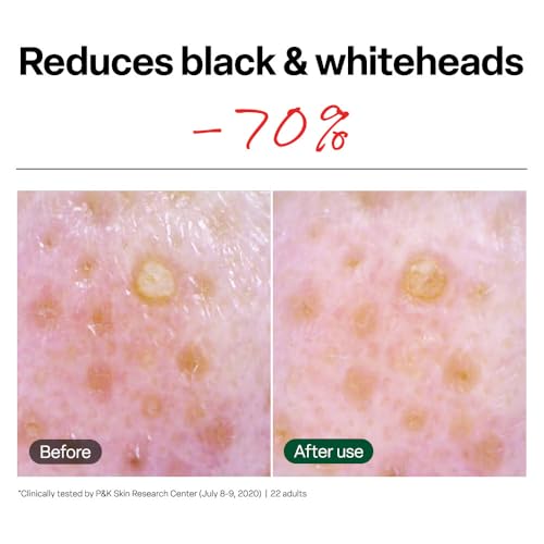Dr. G Brightening Vita Peeling Pads - 70 Count Exfoliating Facial Pads for Skin Tone & Blackhead Removal