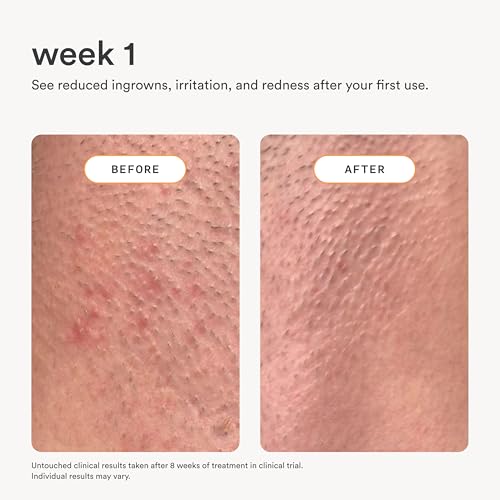 Nood Serum After Shave & Ingrown Hair Treatment - 3.3 Fl Oz - Soothes & Slows Regrowth