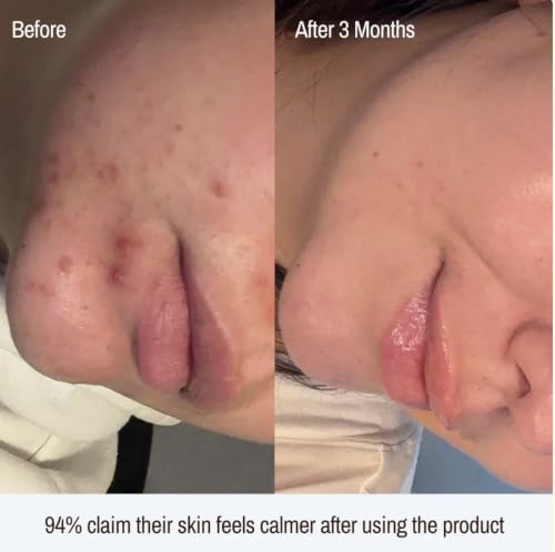 Luminous Moisturizer for Sensitive Skin - Hydrating & Barrier Support