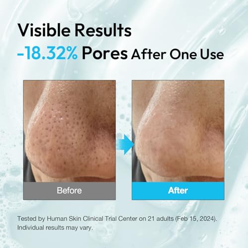 Dual Pore Cleanser, 2-in-1 Oil to Foam Face Wash with Salicylic Acid ? Blackhead Remover & Pore Minimizer ? Korean Skincare for Sebum Control, 200ml (6.76 fl.oz)