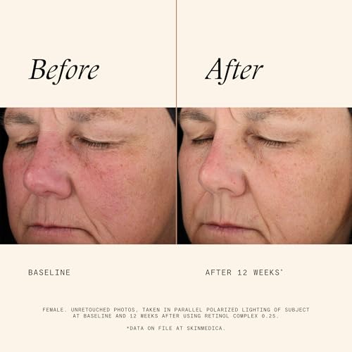 SkinMedica Retinol