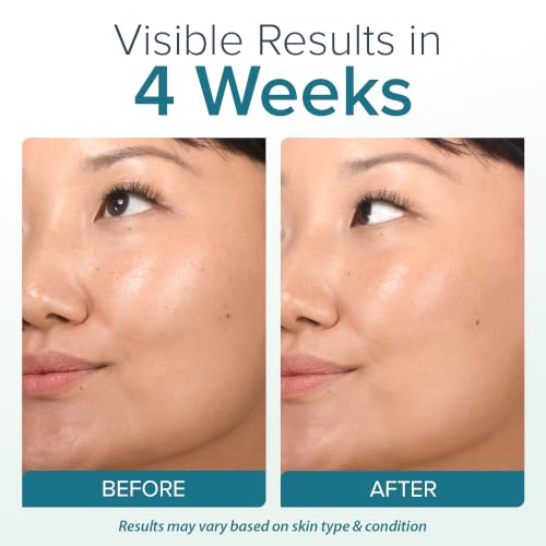 Retinol Face Cream with Collagen & Hyaluronic Acid - Anti-Aging Moisturizer