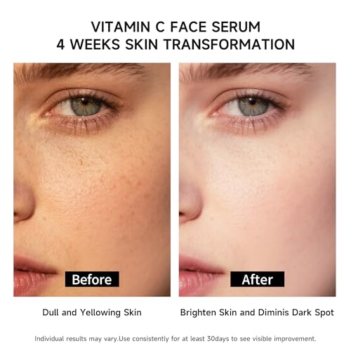 Vitamin C Face Serum with Hyaluronic Acid & Aloe Vera – Brightening & Hydrating Ampoule for Sensitive Skin, 30 Vials