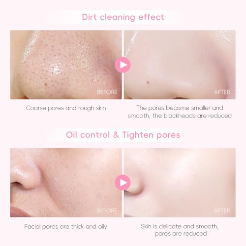 Skin Care Set, Gift Sets Skin Care Kit for Teenage Girls - JAPAN Cherry Blossom Skincare Sets Cleanser, Toner, Serum, Face Cream, Travel Kit for Women Kids Teenagers(15pcs)
