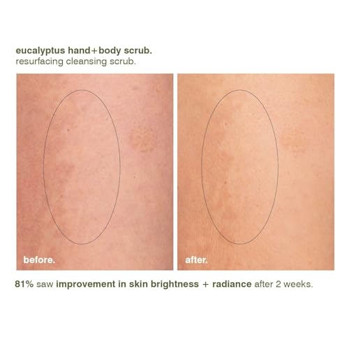 Eucalyptus Hand and Body Scrub - Resurfacing Exfoliant for Sensitive Skin - 8.5 fl oz