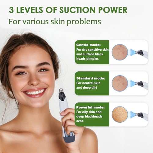 Blackhead Remover Pore Vacuum - Electric Facial Pore Cleaner with 3 Suction Levels & 3 Replaceable Probes - Professional Blackhead Extraction Tool Kit with 4 Stainless Steel Tools for Men & Women