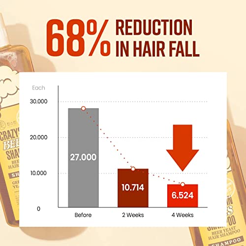 German Beer Yeast Hair Growth Shampoo - 10.15 Fl Oz Pack of 2, Biotin & Natural DHT Blockers, Sulfate-Free, All Hair Types