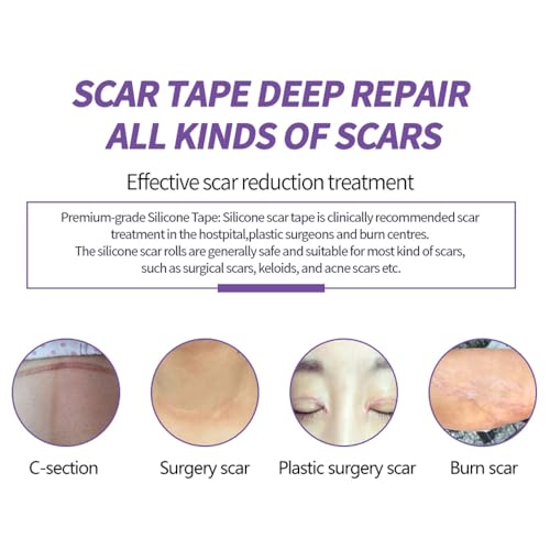 Medical Grade Silicone Scar Sheets - Reusable 1.6" x 60" Scar Removal Tape with Natural Variant