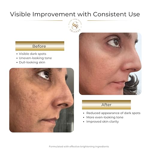 Dark Spots Corrector & Skin Tone Repair Cream for Face with Alpha Arbutin & Kojic Acid – Hydrating 2 oz