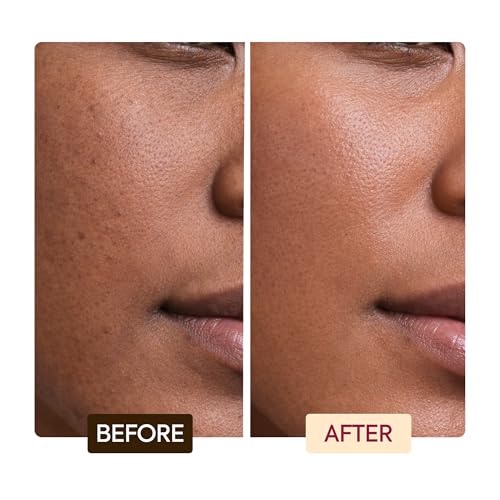 MAKARI Classic Exfoliating Antiseptic Soap (7 oz) | Helps Revitalize Skin | Supports a More Even-Looking Complexion | Detoxifies & Removes Impurities