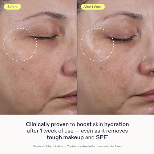 Skinfix Ceramide + Ectoin Gentle Gel Cleanser - 5 oz - SPF + Makeup Remover - Hydrates Skin - Vegan, Cruelty Free