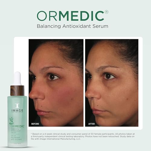 IMAGE Skincare ORMEDIC Balancing Antioxidant Serum – 1 fl oz