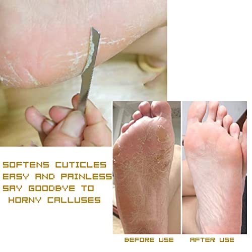 8PCS exfoliating Knife Pedicure Tool, Pedicure Nail Set, Professional Nail Knife Tool, Decorative Foot Cover Care Tool, Foot File Pedicure Set, with Storage Box, Foot File Foot Care, Salon Set