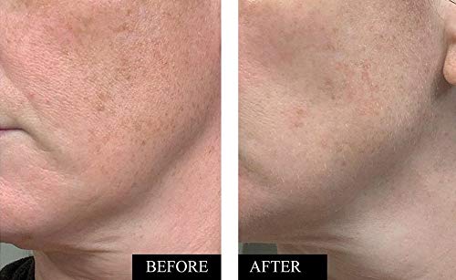 Vitamin C Face Serum Anti-Aging Brightening & Hydrating 1oz Pack of 2