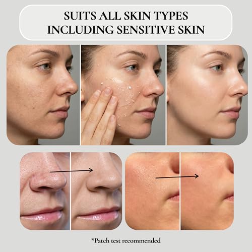 Vivo Per Lei Facial Peeling Gel - Helps Address Dead Skin Buildup - Gentle Exfoliating Gel for Rough, Dry, Sensitive or Mature Skin - Face and Body Scrub - Non Abrasive - 4.05 Fl. Oz. - Pack of 3