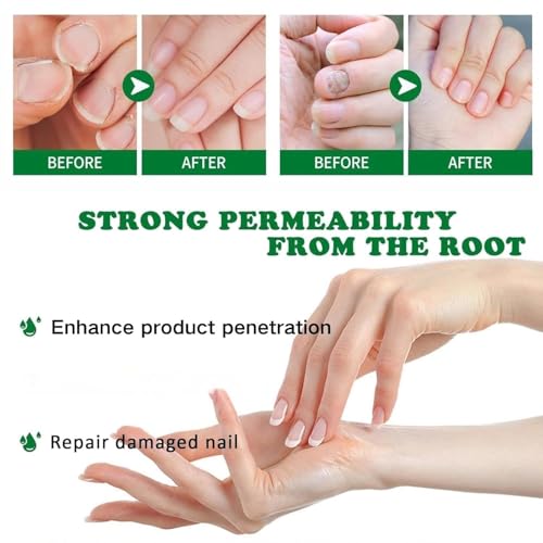 7 days Nail Treatment, Ginger Nail Treatment, Nail Nutrient Oil Strengthener Oil