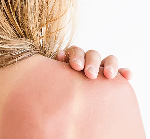 After Sun Body Mousse - Cooling Hydrating Relief for Sun-Exposed Skin