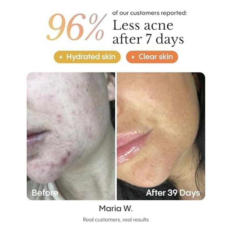 FR¨ªYA Organics | Blemish Control & Redness Relief Balm | Helps Clear Breakouts & Restore Oil Balance | Calendula & Lavender Cleanse Pores | Reduce Facial Redness | Prevent Future Breakouts | 30ml